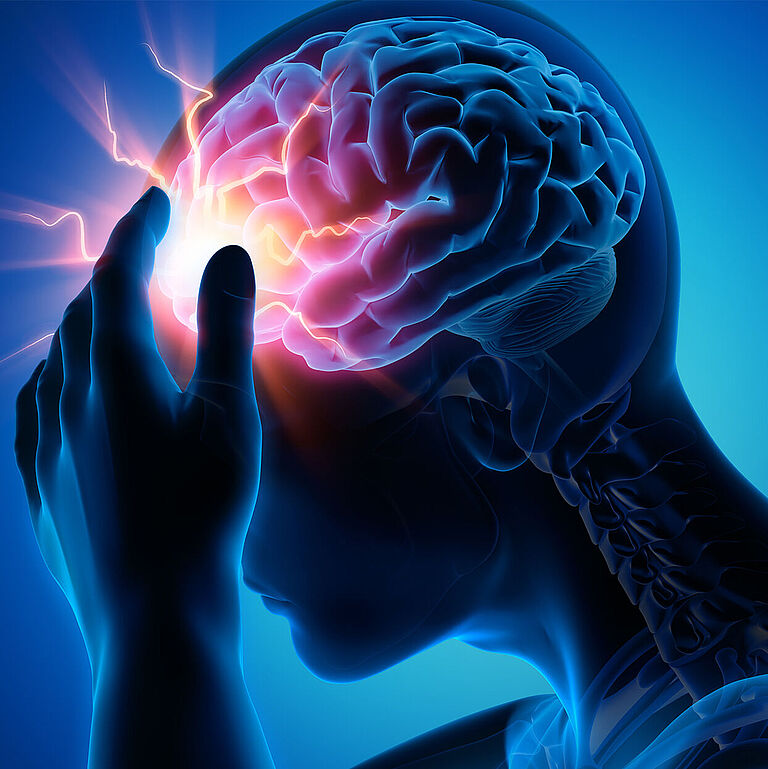 Eine Grafik zeigt einen Schlaganfall im Kopf, hell erleuchtet. Der Mensch fasst sich an die Stirn.