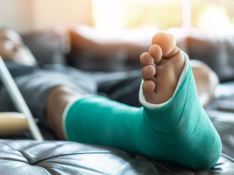 Knochenbruch an Fuß und Bein bei einem männlichen Patienten mit Gipsschiene und Krücken während der chirurgischen Rehabilitation und orthopädischen Genesung zu Hause